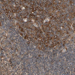 RIOK2 Antibody, Novus Biologicals:Antibodies:Primary Antibodies